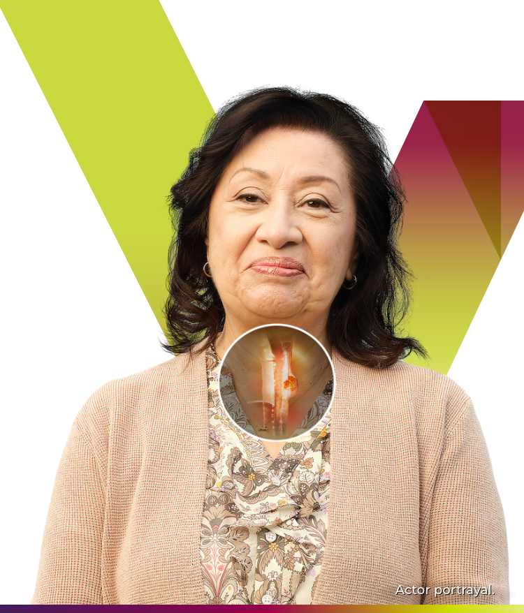 TEVIMBRA® (tislelizumab-jsgr) patient