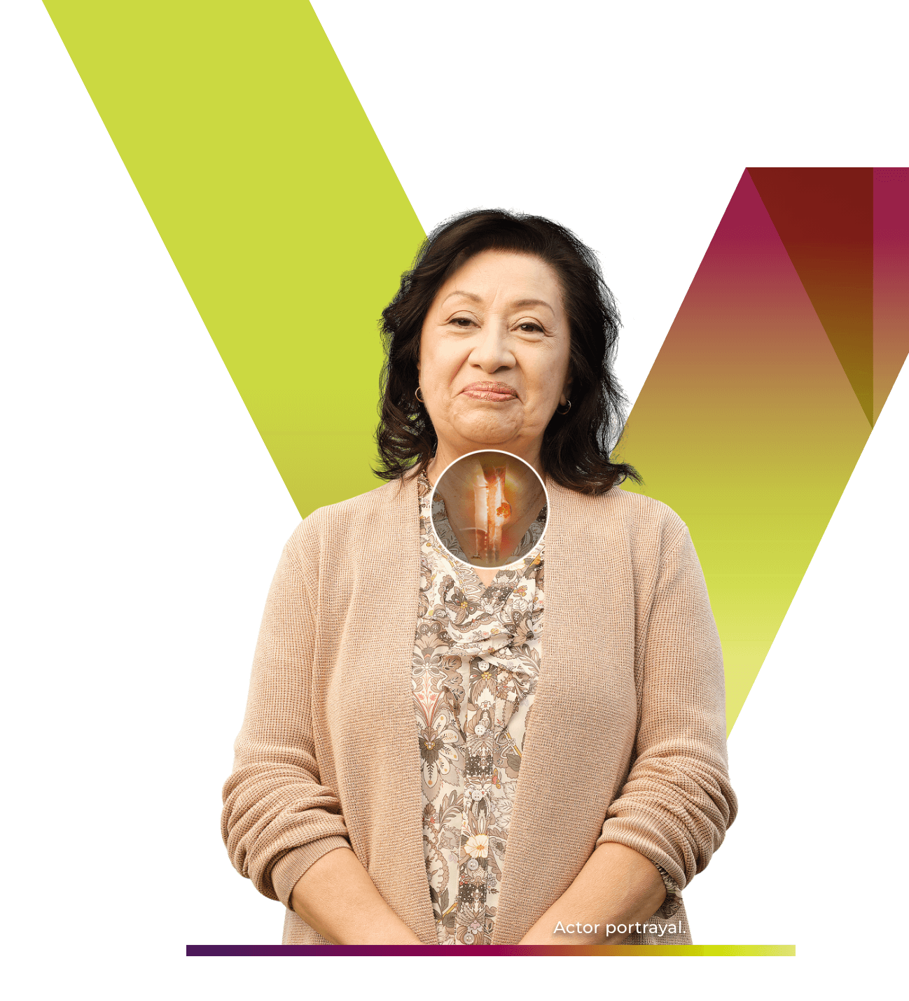 TEVIMBRA® (tislelizumab-jsgr) patient