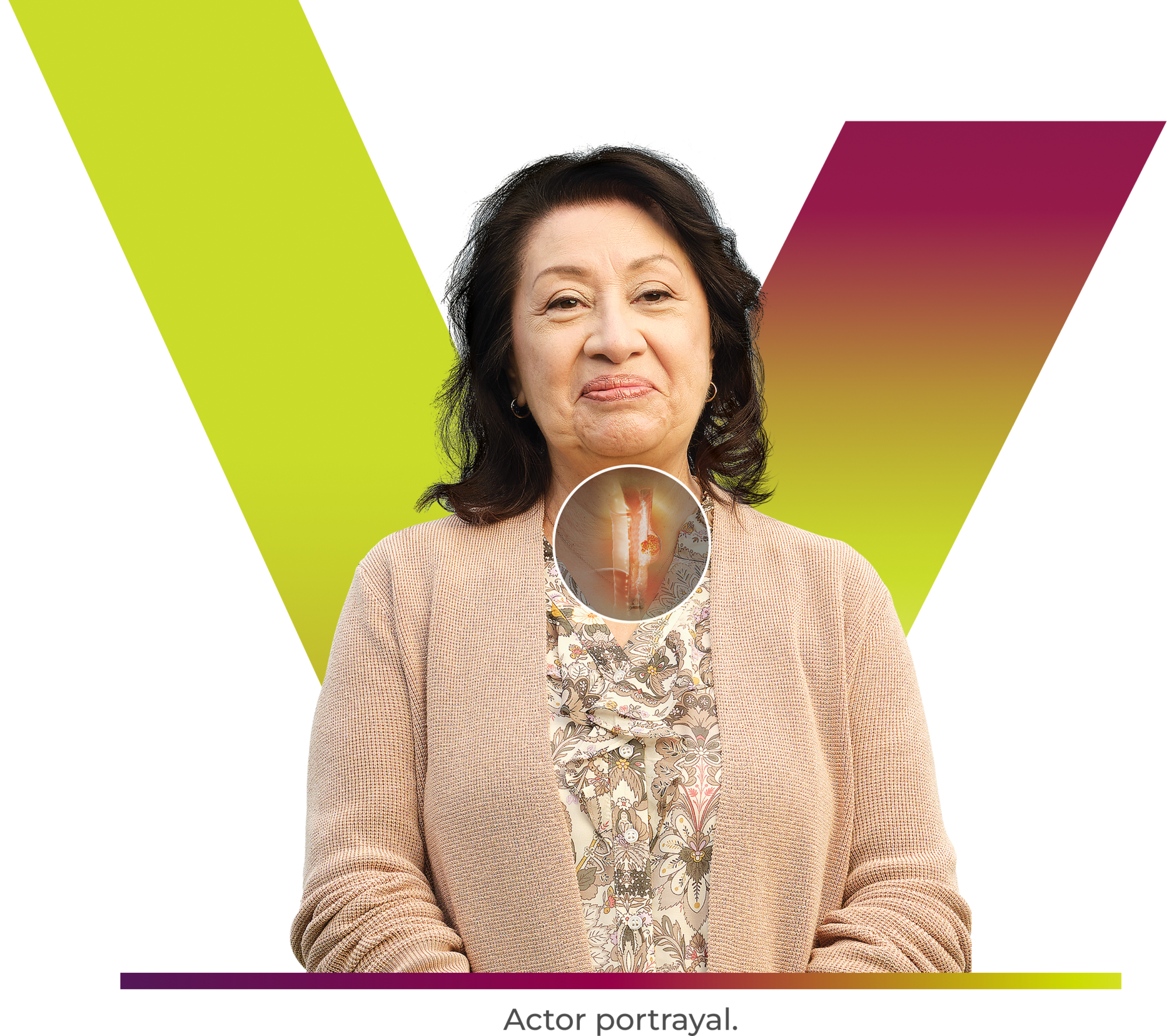 TEVIMBRA® (tislelizumab-jsgr) patient