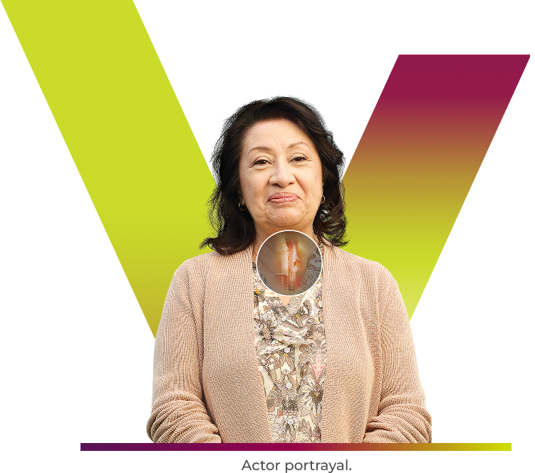 TEVIMBRA® (tislelizumab-jsgr) patient